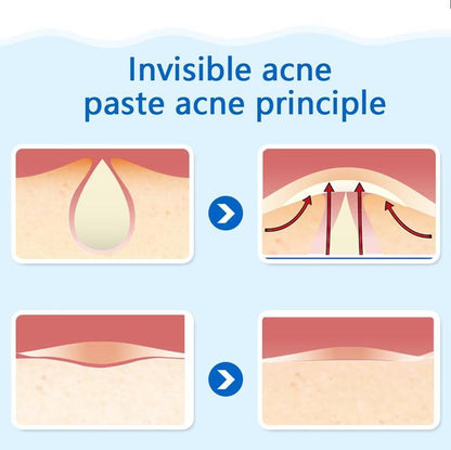 Skin tag remover patch
